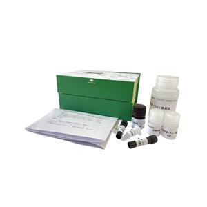 血清总铁结合力(TIBC)测定试剂盒/比色法/48样,TIBC ELISA KIT