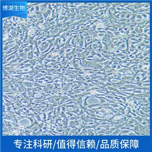 KMS-11人多发性骨髓瘤细胞