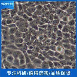 KNS-81人脑部多形性成釉细胞瘤细胞