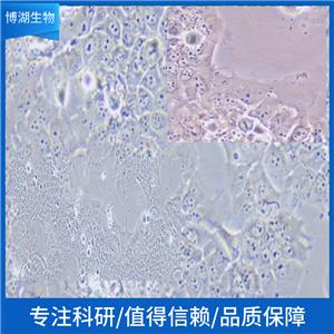 HuTu 80人十二指肠腺癌细胞,Human Duodenal Adenocarcinoma Cell Line