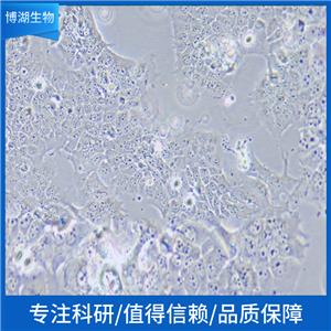 IGR-1人黑素瘤细胞