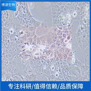 IM-9人多发性骨髓瘤细胞