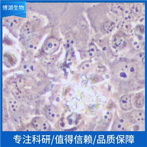 HSC-4人头颈部鳞状细胞癌细胞