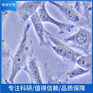 HDLM-2人霍奇金淋巴瘤细胞,HDLM-2