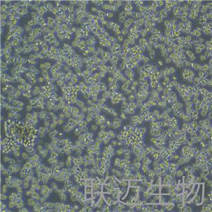 YAC-1细胞（小鼠淋巴瘤细胞）LM8C0246,YAC-1