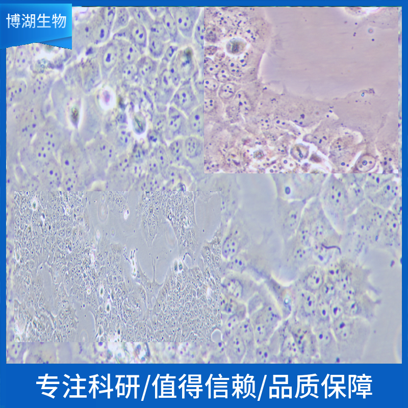 NCI-H2405人非小细胞肺癌细胞,NCI-H2405