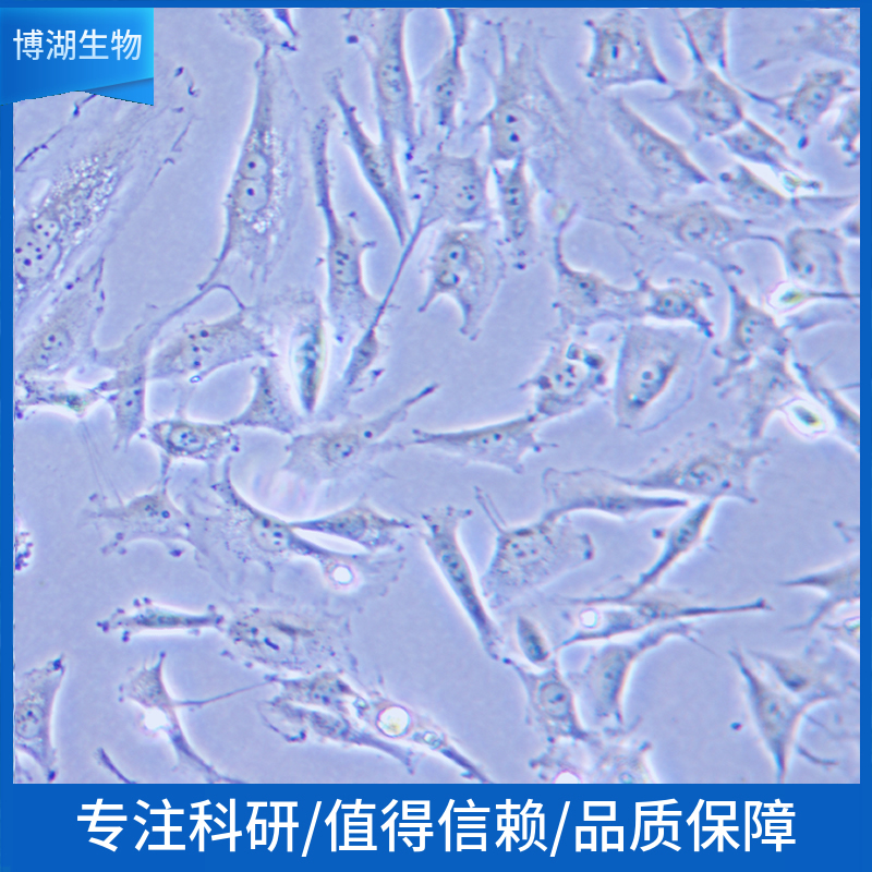 NCI-H209人小细胞肺癌细胞,NCI-H209