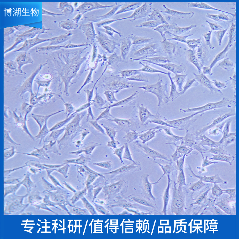 NCI-H1581人非小细胞肺癌细胞,NCI-H1581