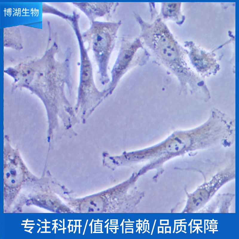 NCI-H1666人肺支气管癌细胞,NCI-H1666