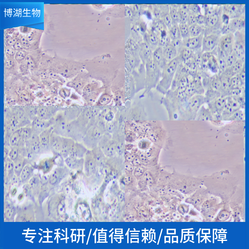 NCI-H820人非小细胞肺癌细胞,NCI-H820