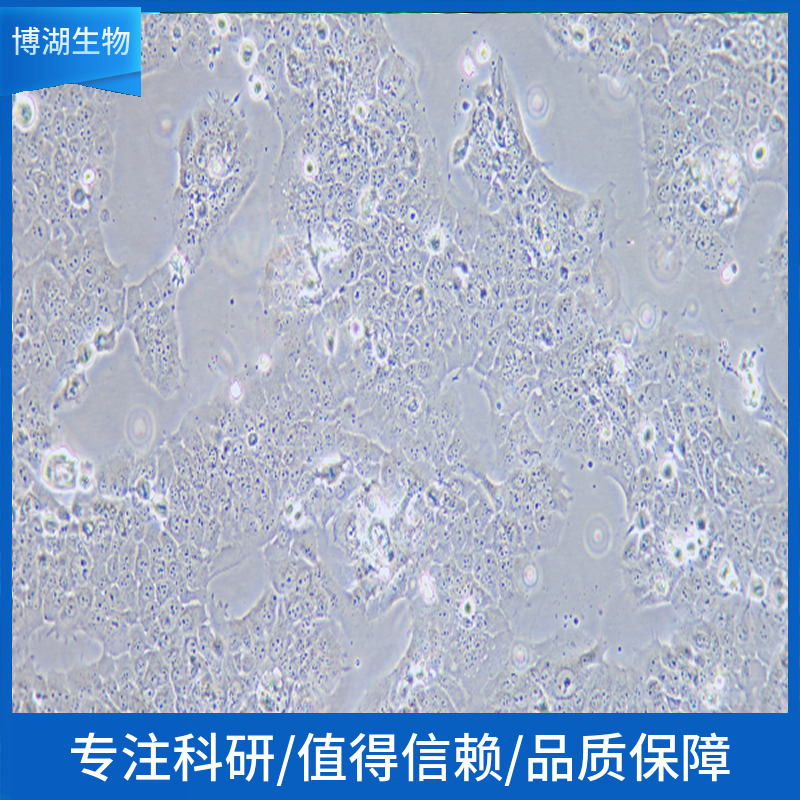 NCI-H841人小细胞肺癌细胞,NCI-H841