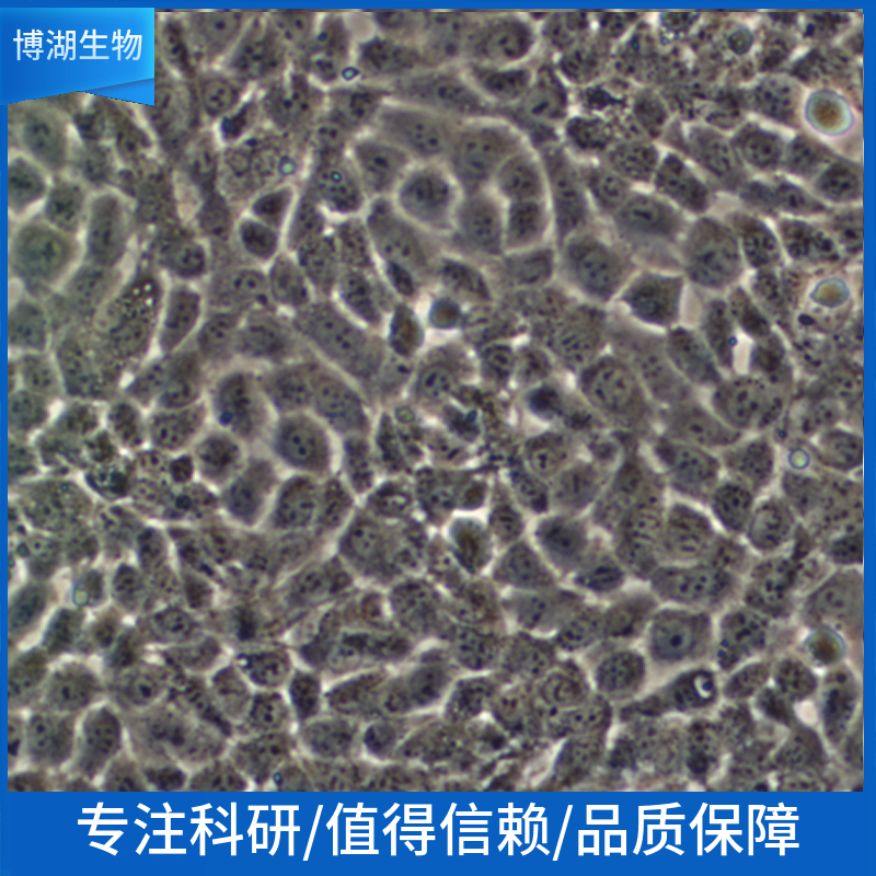 NOMO-1人白血病细胞,NOMO-1