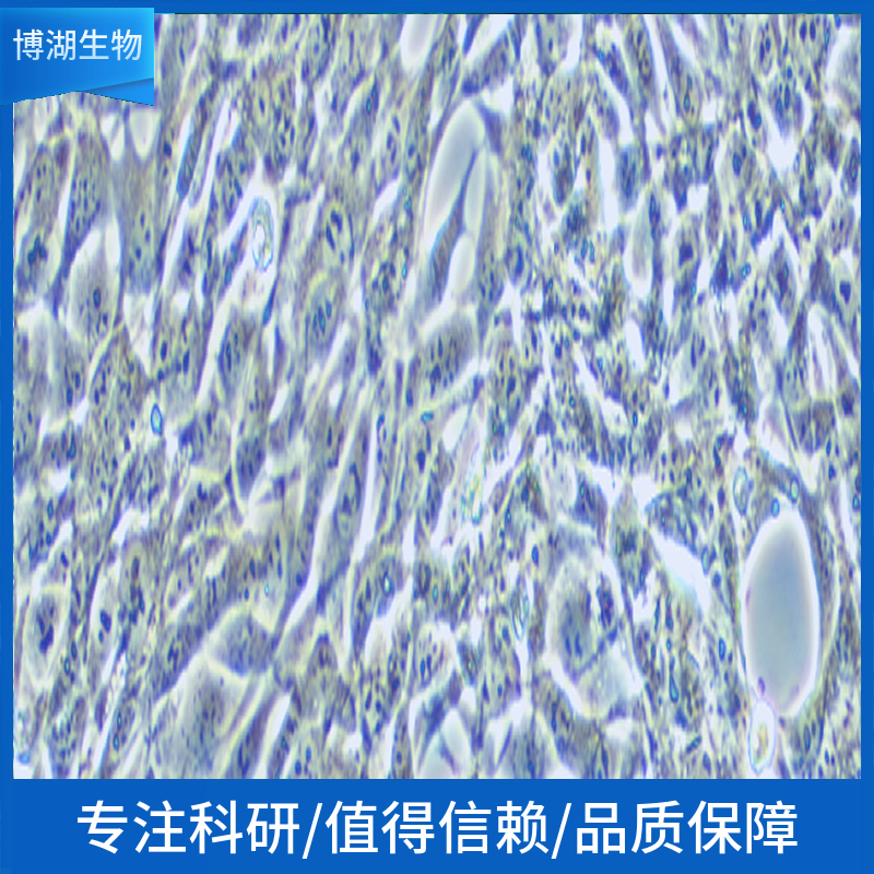 NCI-H1793人非小细胞肺癌细胞,NCI-H1793