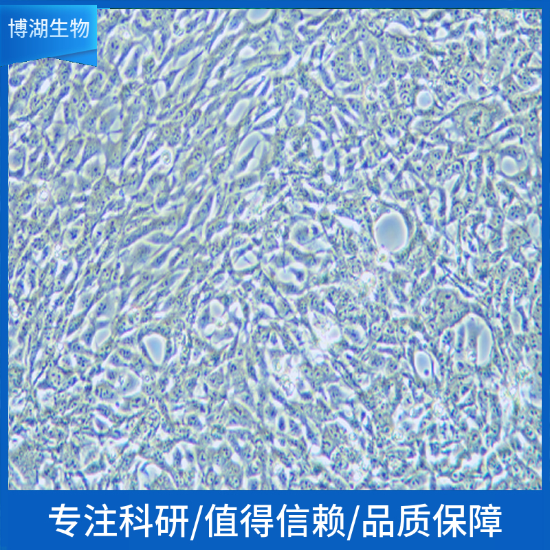NCI-H2195 [H2195]人小细胞肺癌,NCI-H2195 [H2195]
