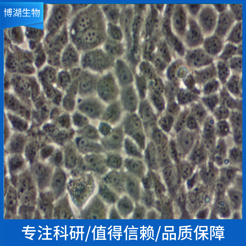 NCI-H2172人非小细胞肺癌细胞,NCI-H2172