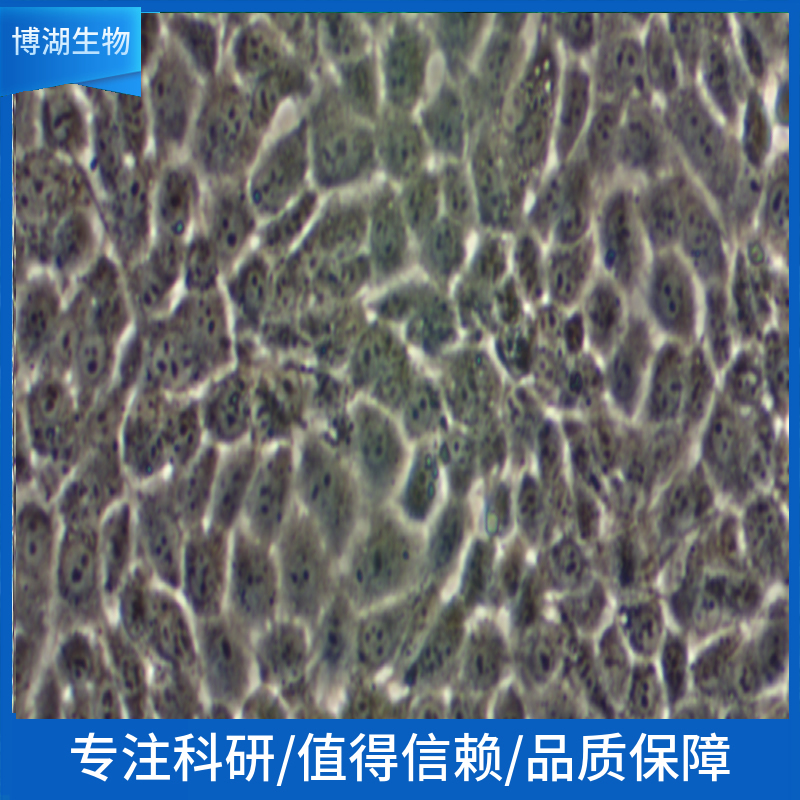 NCI-H1915人非小细胞肺癌细胞,NCI-H1915