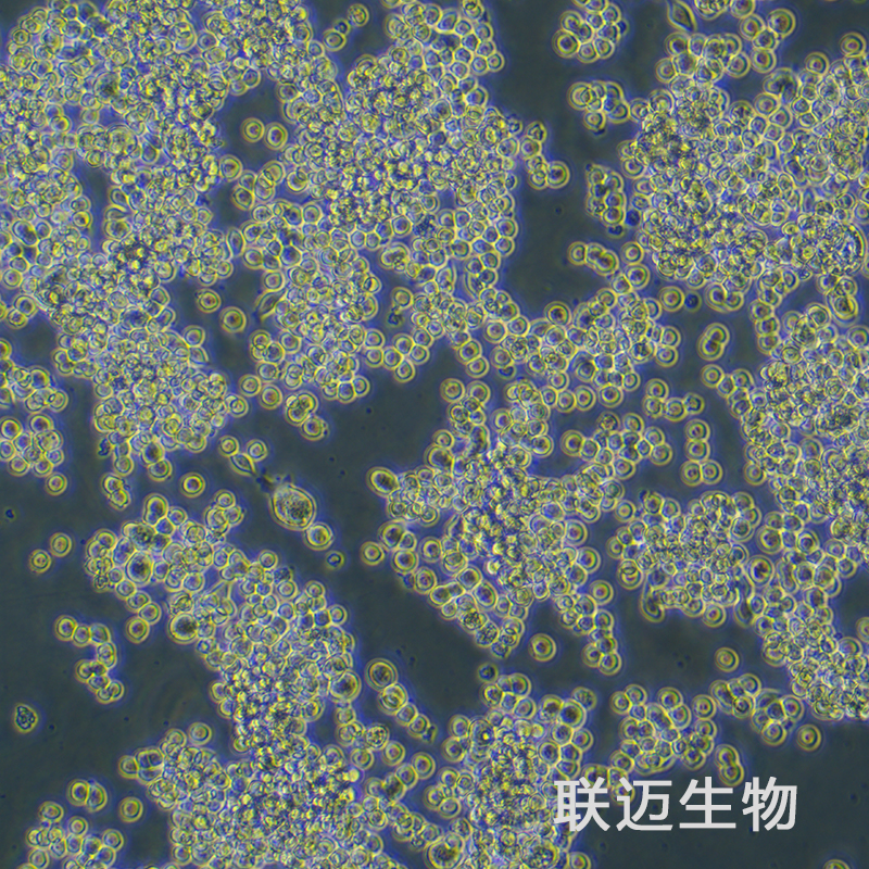 MKN-45细胞（胃癌细胞STR鉴定正确）LM8C0292,MKN-45