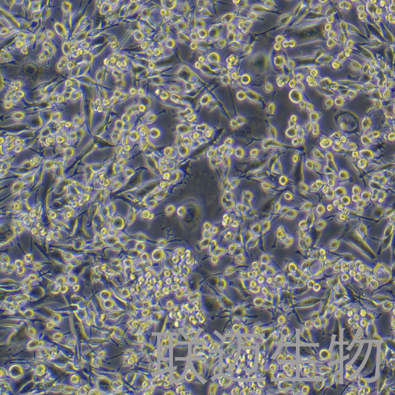 LA795细胞（小鼠肺腺癌细胞）LM8C0376,LA795