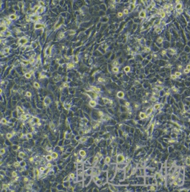 TE-11细胞（食管癌细胞）LM8C0454,TE-11