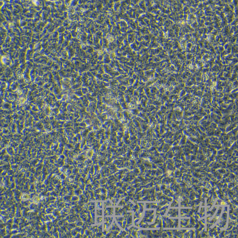 PA-1细胞（卵巢畸胎瘤细胞）LM8C0411,PA-1