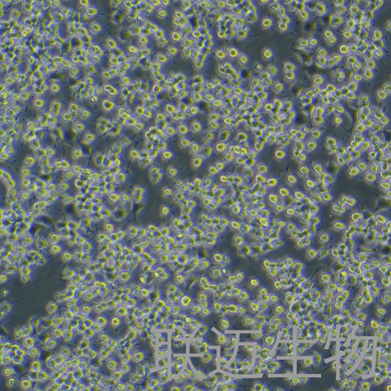 RIN-m5F细胞（大鼠胰岛β细胞瘤细胞）LM8C0423,RIN-m5F