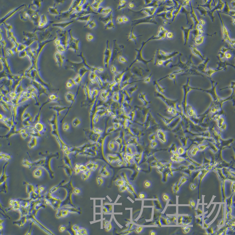 PC-12 (低分化)细胞（大鼠肾上腺嗜铬细胞瘤细胞-低分化）LM8C0480,PC-12