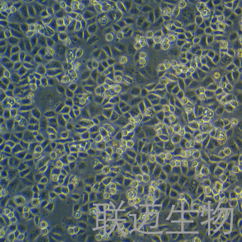 AGS细胞（胃腺癌细胞STR鉴定正确）LM8C0022,AGS