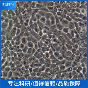 NCI-H460人非小细胞肺癌细胞,NCI-H460