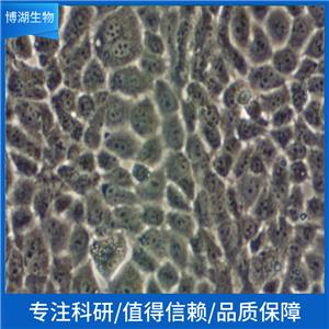 OVTOKO人卵巢癌细胞