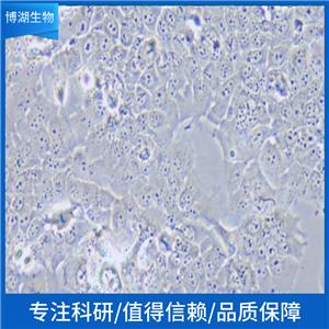 NCI-H1930人小细胞肺癌,NCI-H1930