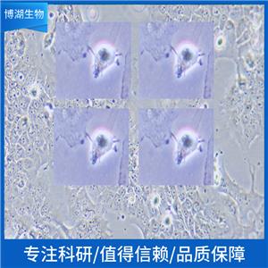 NCI-H1930人小细胞肺癌,NCI-H1930