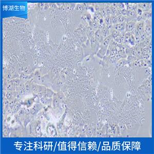 NCI-H2405人非小细胞肺癌细胞,NCI-H2405