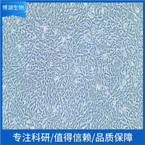 NCI-H1693人非小细胞肺癌细胞,NCI-H1693