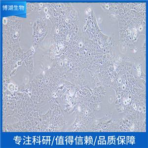 NCI-H1693人非小细胞肺癌细胞,NCI-H1693