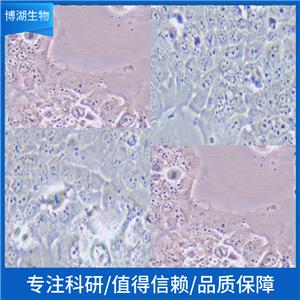 NCI-H820人非小细胞肺癌细胞