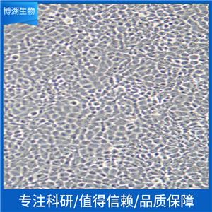 NM2C5人黑素瘤细胞,Human Malignant Melanoma Cells (WM-115)