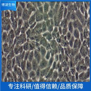 NCI-H1915人非小细胞肺癌细胞