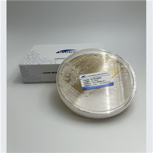 Ferruginibacter Alkalilentus