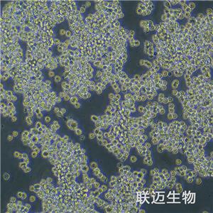 MKN-45细胞（胃癌细胞STR鉴定正确）LM8C0292