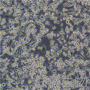 LA795细胞（小鼠肺腺癌细胞）LM8C0376,LA795