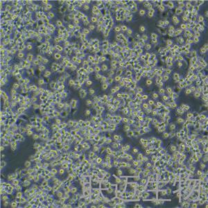 RIN-m5F细胞（大鼠胰岛β细胞瘤细胞）LM8C0423,RIN-m5F