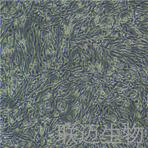 PC-12 (高分化)细胞（大鼠肾上腺嗜铬细胞瘤细胞-高分化）LM8C0481