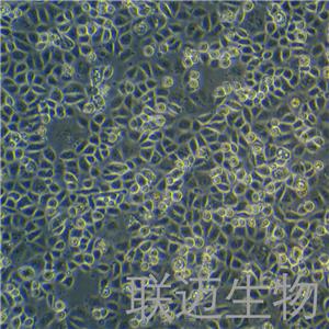 AGS细胞（胃腺癌细胞STR鉴定正确）LM8C0022