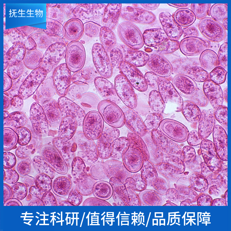 人乳腺导管癌细胞；MDA-MB-134-VI (STR),MDA-MB-134-VI (STR)