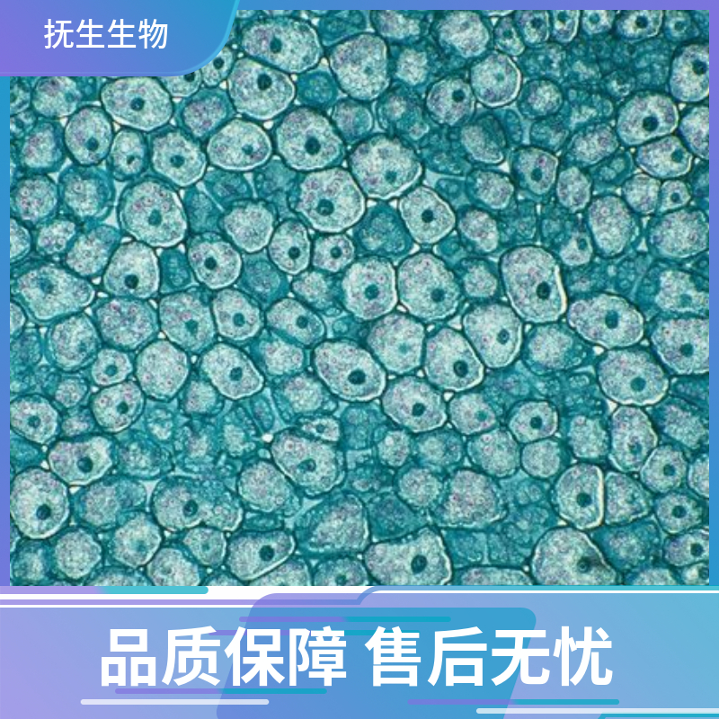 人肝癌细胞-荧光素酶标记;HepG2-LUC,HepG2-LUC