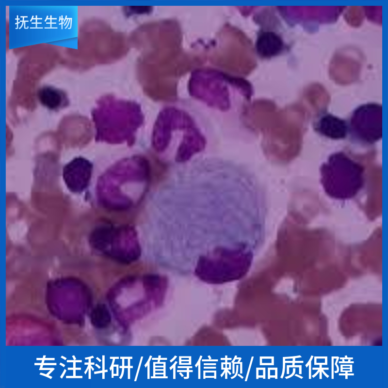 人支气管上皮样细胞；16HBE,16HBE