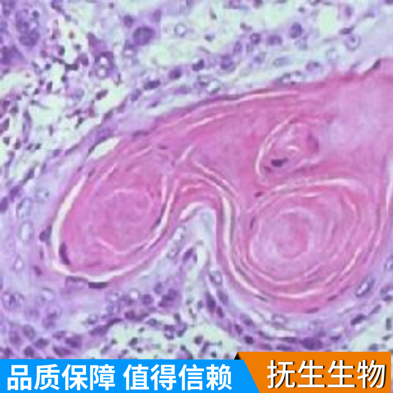 人肺癌细胞；A549/OVA,A549/OVA