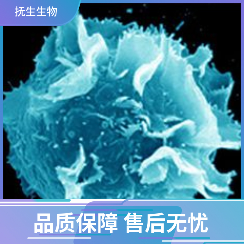 KLM-1细胞,KLM1:KLM-1