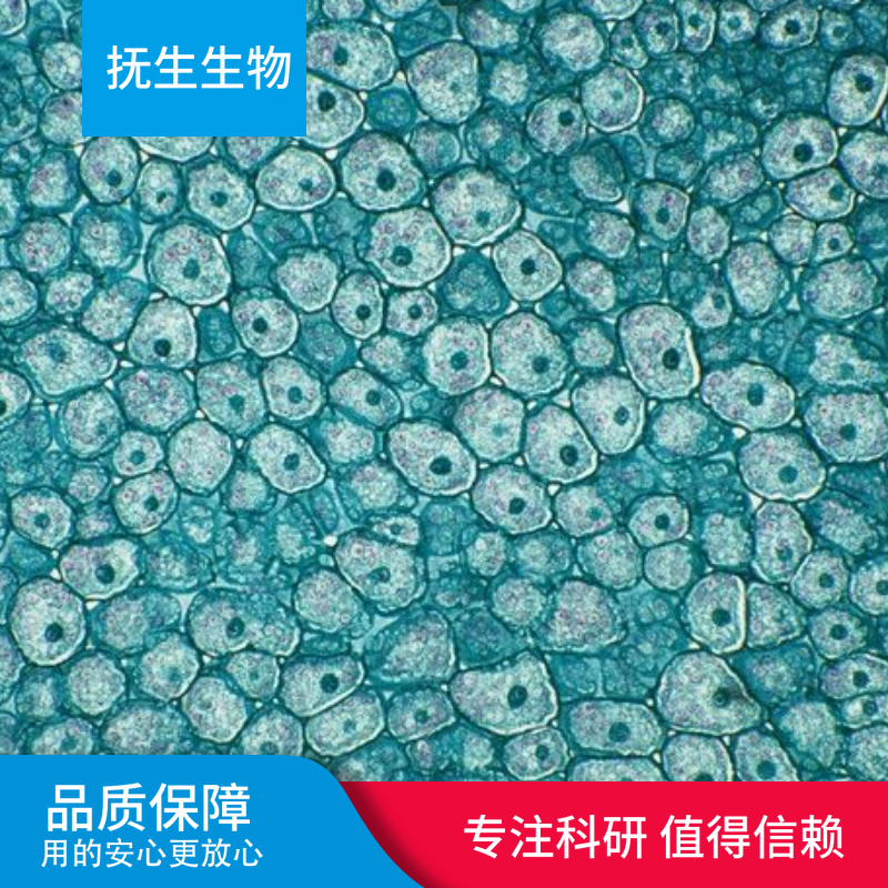 GCT  人纤维肉瘤细胞,GCT:GCT