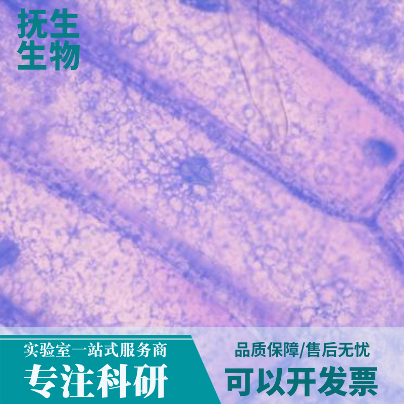 RT112/84人膀胱癌细胞,RT11284:RT112/84